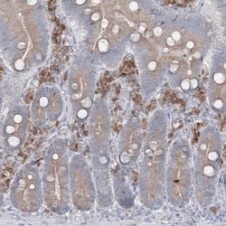 IFN-alpha/beta R1 Antibody, Novus Biologicals 0.1mL; Unlabeled:Antibodies,